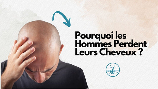 Pourquoi les hommes perdent leurs cheveux ?